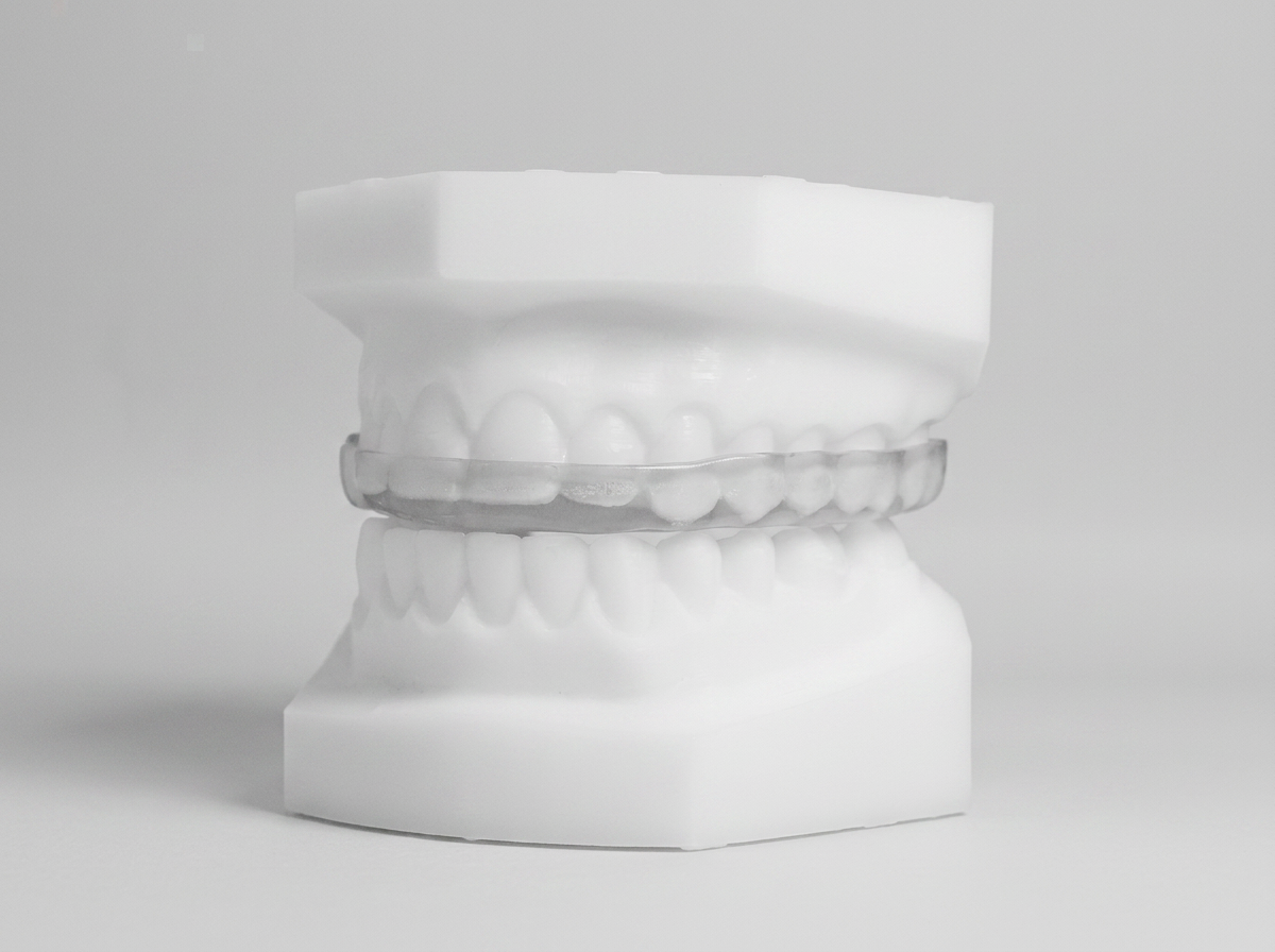 Bite Splints